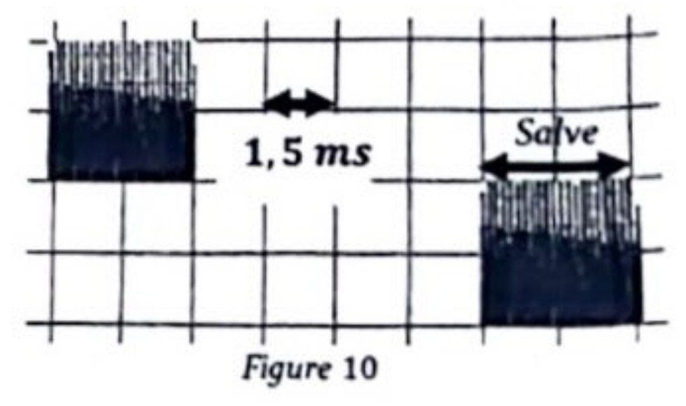 Figure 10 : Ultrasons