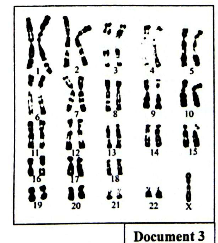 Document 3 - Caryotype de l'individu III7